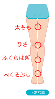 誰でもわかる ｘ脚 O脚について みどり堂整骨院