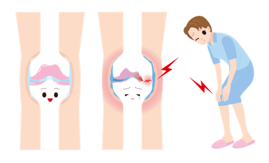 誰でもわかる x脚 O脚について みどり堂整骨院