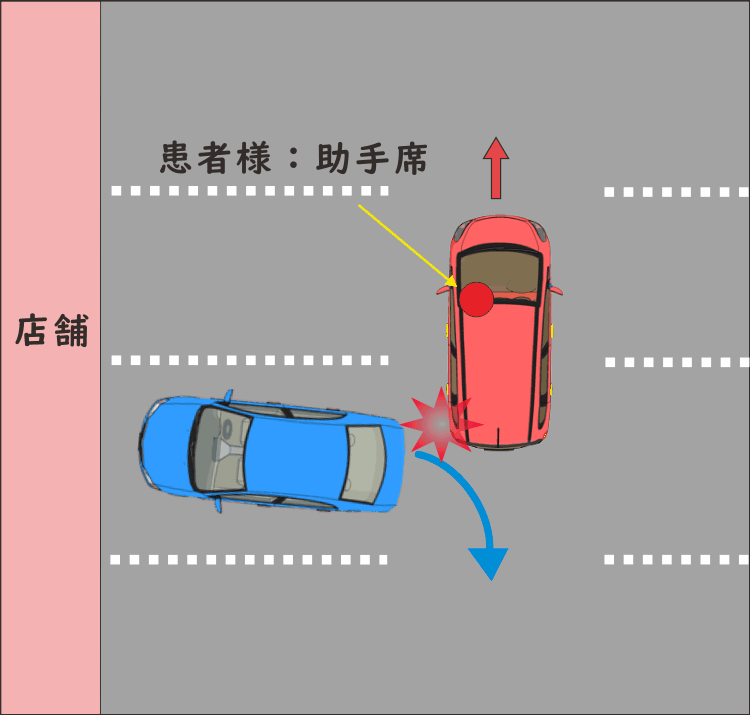 交通事故12 】駐車場内を徐行中、バックしてきた車に衝突された。 八王子・みどり堂整骨院 交通事故12 】駐車場内を徐行中、バックしてきた車に衝突された。 八王子・みどり堂整骨院