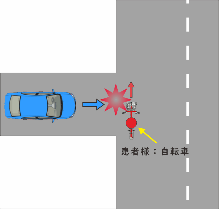 交通事故19 自転車で走っていた時 横から出てきた車と接触 みどり堂整骨院