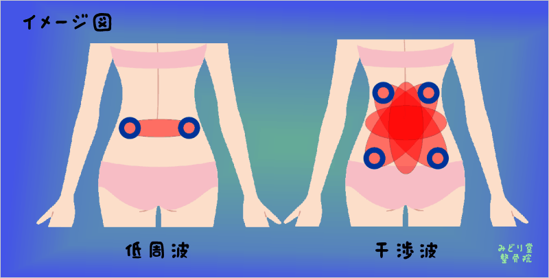 低周波と干渉波の違い