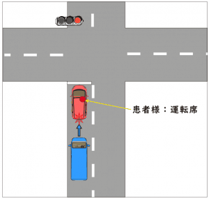 交通事故の事例