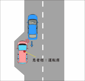 道路の路肩に停車中、バックしてきた車と接触してしまった交通事故の図