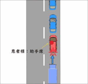 渋滞の最後尾で停車中に、後ろからトラックに追突された交通事故の図