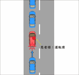 渋滞最後尾で停車中、後方から追突された交通事故の図