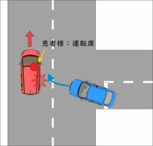 車を運転中に、右折車に横から追突された交通事故のイラスト