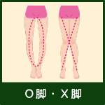 Ｏ脚・Ｘ脚