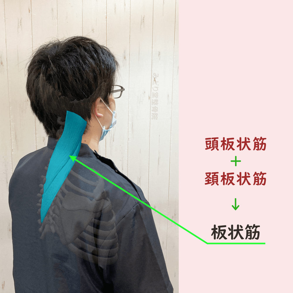 板状筋の位置をスタッフ写真に重ねて示した図解画像（モデル：副院長・長尾）