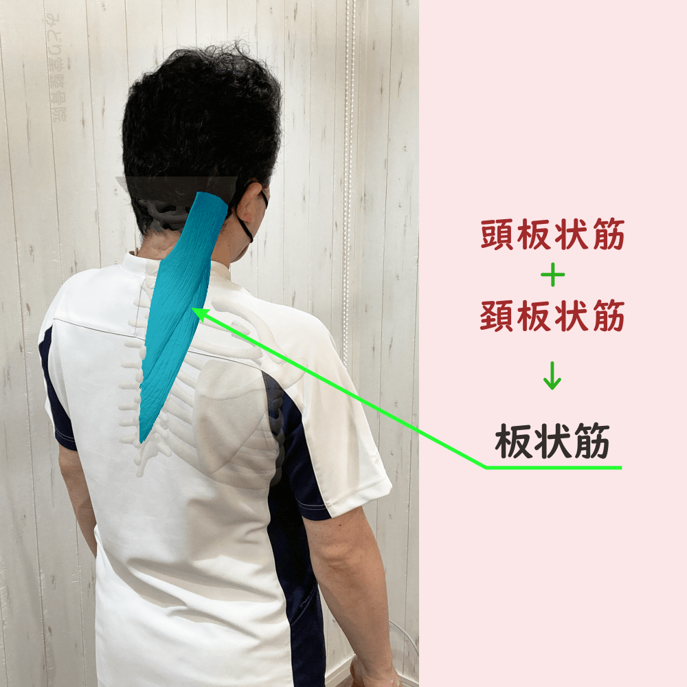 板状筋の位置をスタッフ写真に重ねて示した図解画像（モデル：院長・臼田）