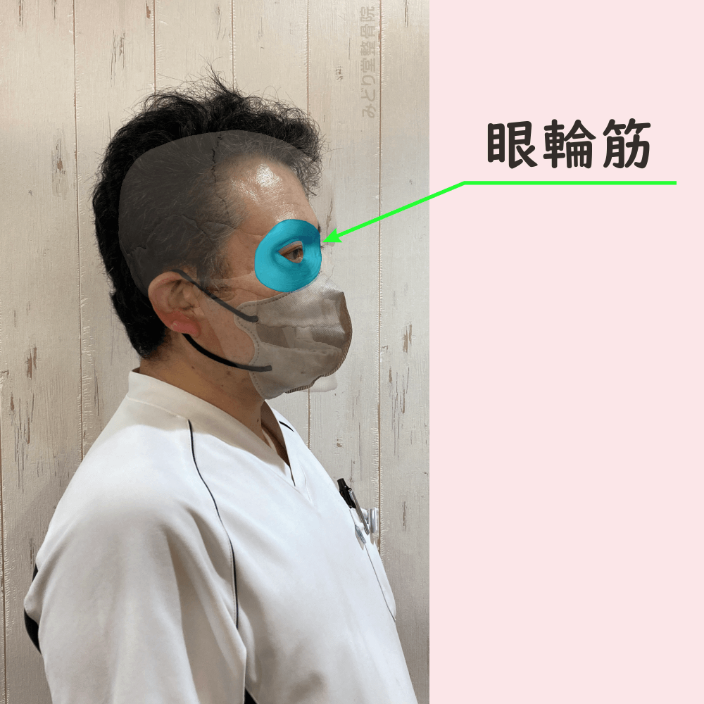 眼輪筋の位置をスタッフ写真に重ねて示した図解画像（モデル：院長・臼田）