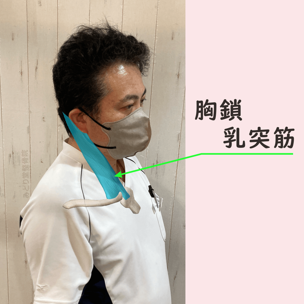 胸鎖乳突筋の位置をスタッフ写真に重ねて示した図解画像（モデル：院長・臼田）