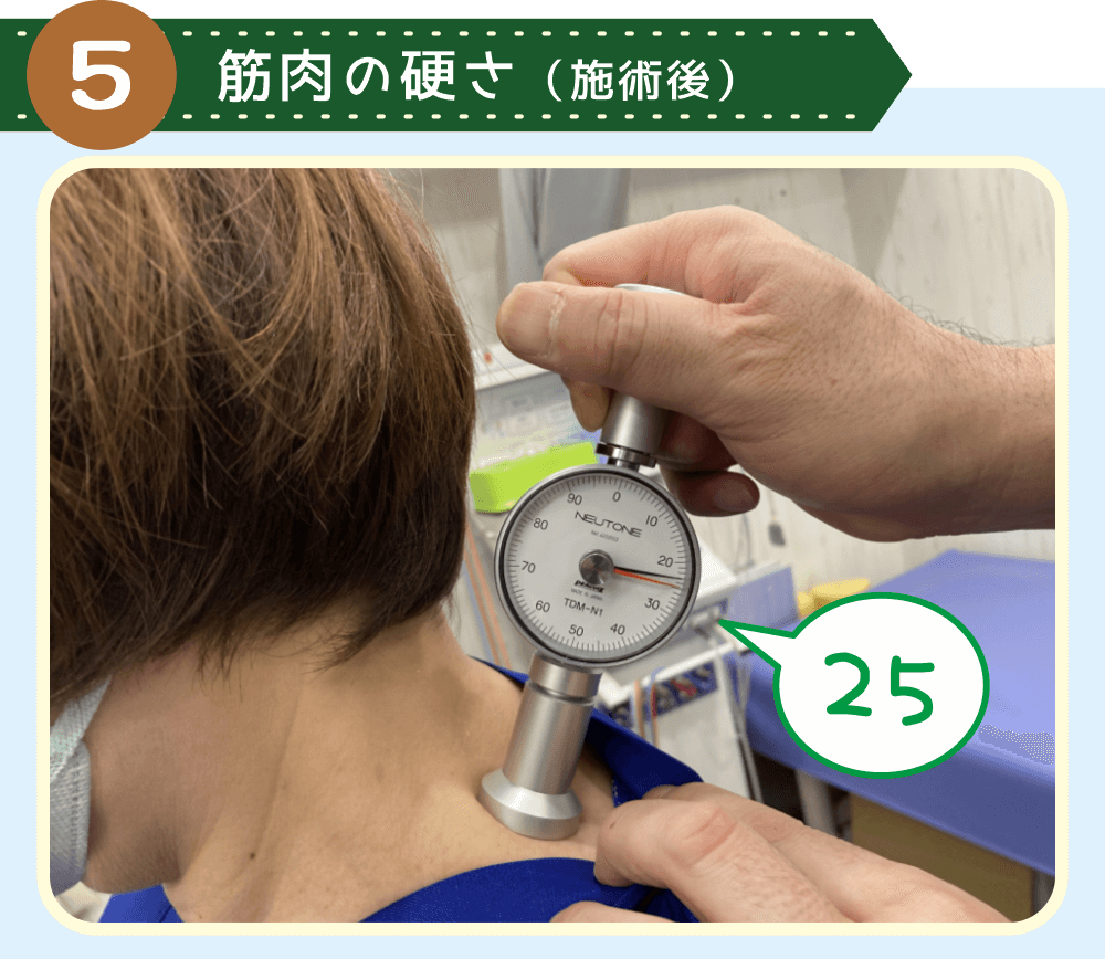 リンパ調整の施術後に、筋硬度計で肩の筋肉の硬さを測定。数値は２５でした。
