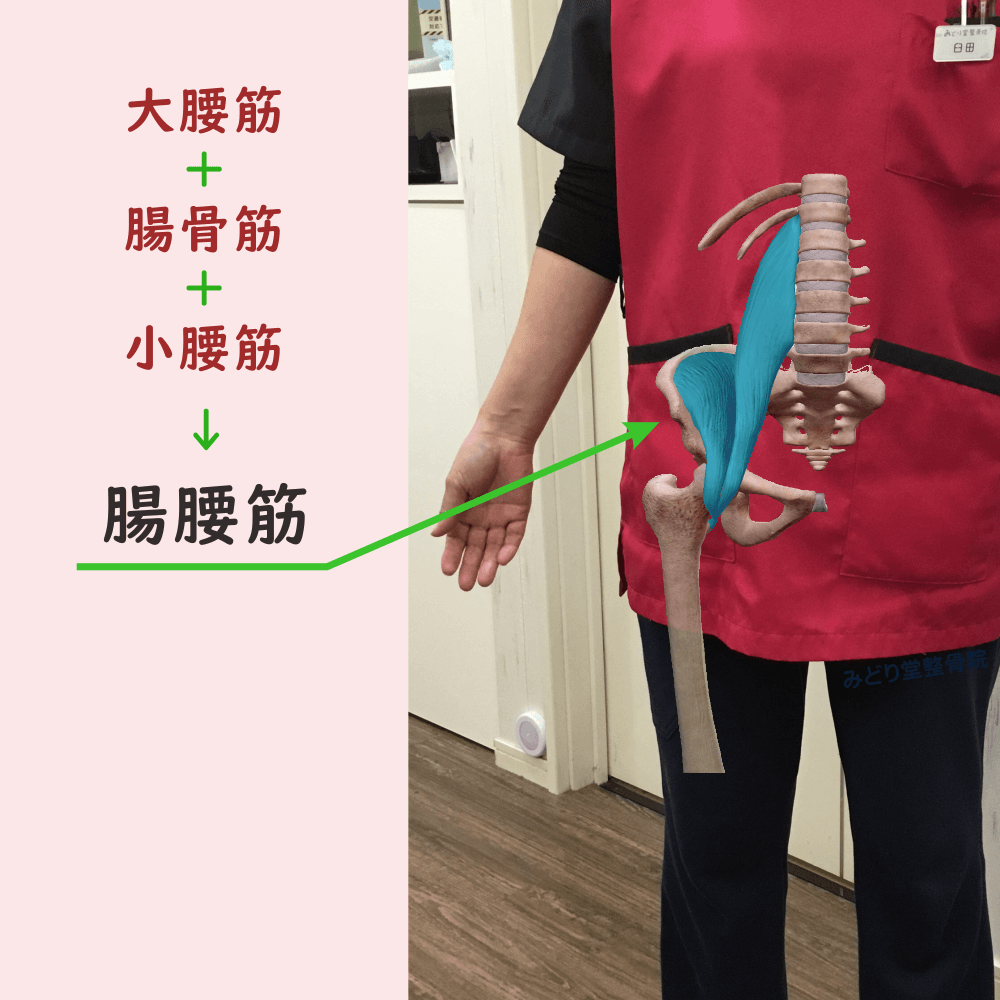 腸腰筋の位置をわかりやすく示した写真