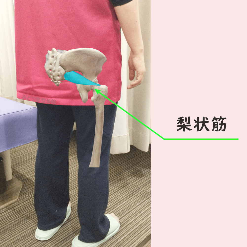 梨状筋の位置をわかりやすく示した写真