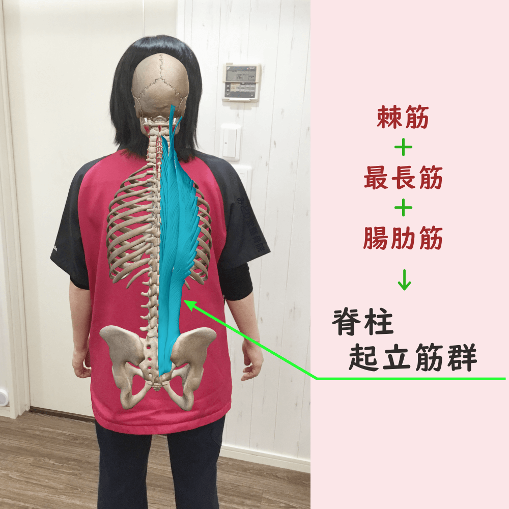脊柱起立筋群の位置をわかりやすく示した写真