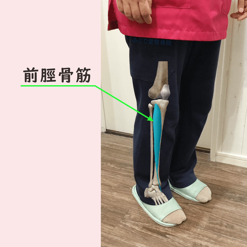 階段を下りる動作で負担の掛かりやすい「前脛骨筋」の位置を示した図